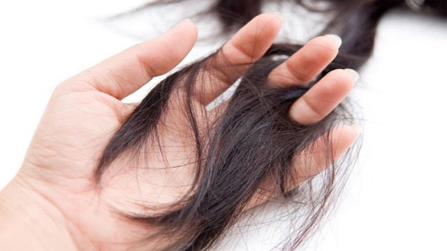 Mơ thấy rụng tóc khi vuốt là dự báo không may Mơ thấy rụng tóc khi vuốt là dự báo không may